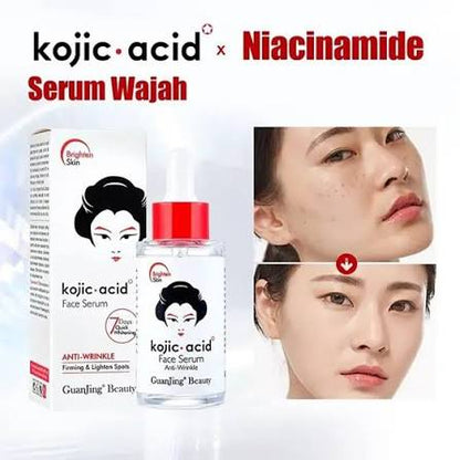 سيروم الوجه Kojic Acid x Niacinamide | تفتيح ومكافحة التجاعيد والبقع
